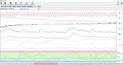 Polygraph Blue box new version with 4 Sensors, with AI integration, Made by Experts